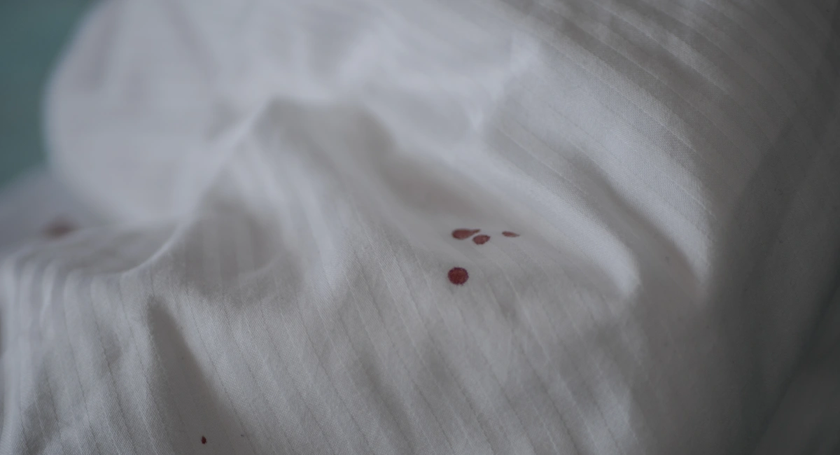Small spots of blood on a white bed sheet.