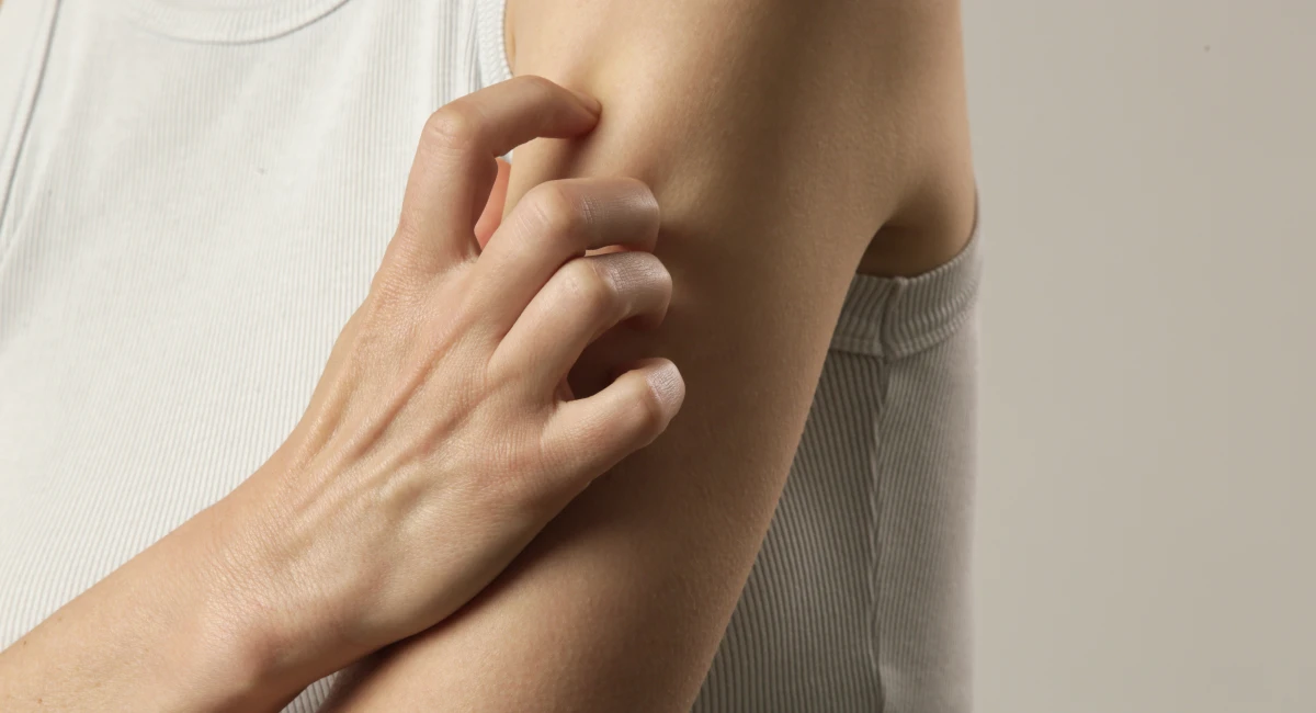 A person scratches their upper arm.