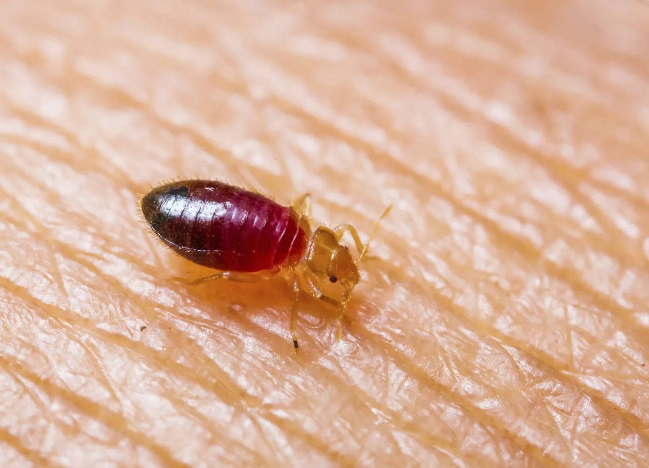 Bed bug on skin