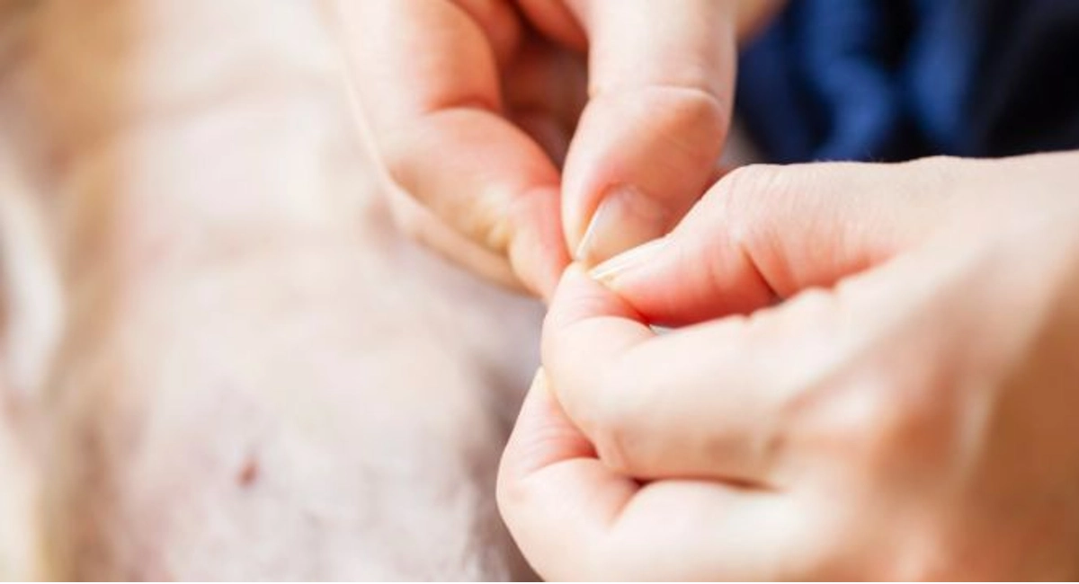 A male crushing a tick between his fingers. Not removing a tick the proper way.