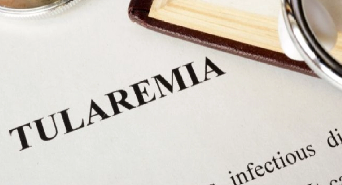 Tularemia