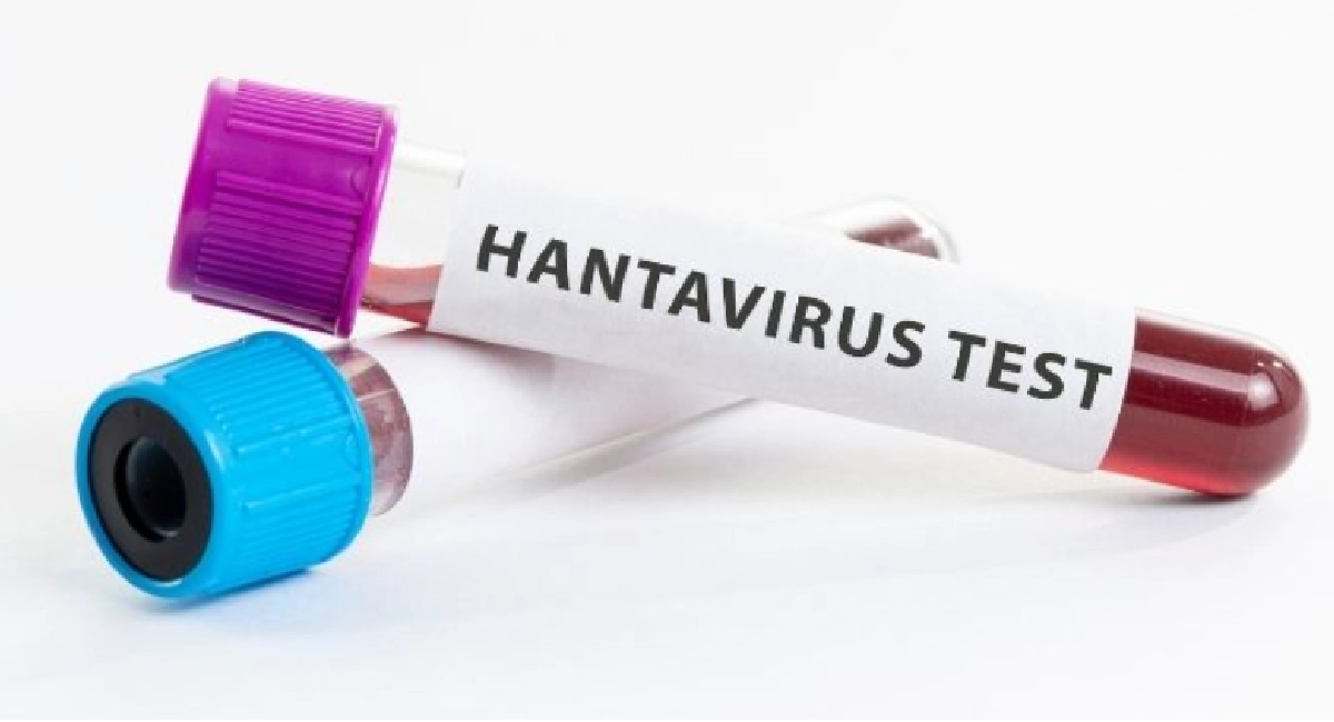 Hantavirus test